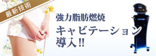キャビテーション