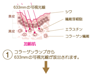 コラーゲンランプから633mmの可視光線が放出されます。