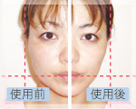 フォトリフレッシュイメージ