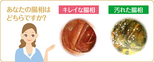 あなたの腸相はどちらですか